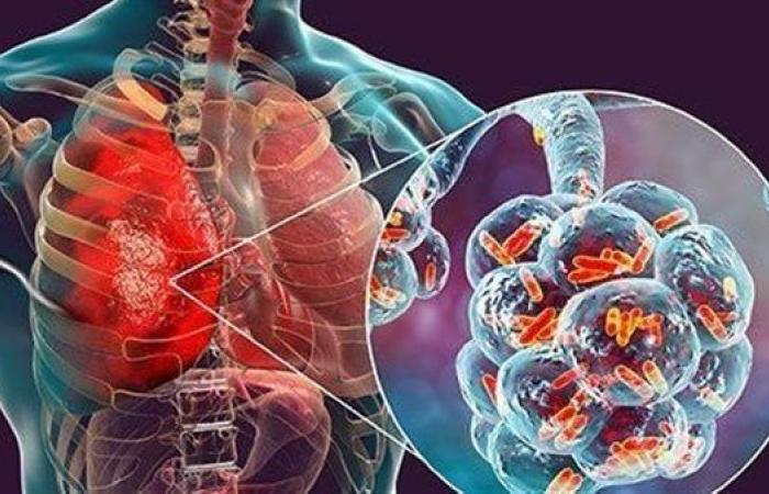 خلوا
      بالكم
      في
      البرد..
      هؤلاء
      الأكثر
      عرضة
      للإصابة
      بالالتهاب
      الرئوي .. بوابة المساء الاخباري