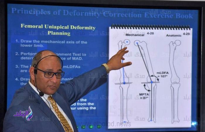 أستاذ جراحة عظام بالأزهر يترأس مجموعة التعامل مع الكوارث بالرابطة الدولية .. بوابة المساء الاخباري