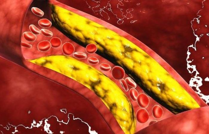 بذور غير متوقعة تعالج الكوليسترول ودهون الدم .. بوابة المساء الاخباري