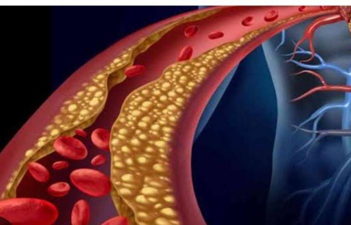 وجبات تخفض مستوى الكوليسترول وتقلل خطر الإصابة بالنوبات القلبية .. تعرف عليها .. بوابة المساء الاخباري