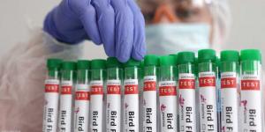 الفجر سبورت .. العالم
      اليوم
      -
      أول
      وفاة
      بشرية
      بمتحور
      لإنفلونزا
      الطيور..توضيح
      من
      منظمة
      الصحة